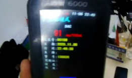 slnu3k91mg直播,揭秘网络直播的魅力与挑战